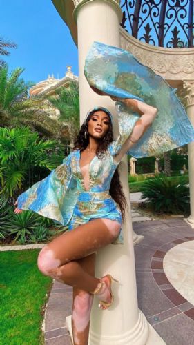 Winnie Harlow rompe estereotipos y presume su figura