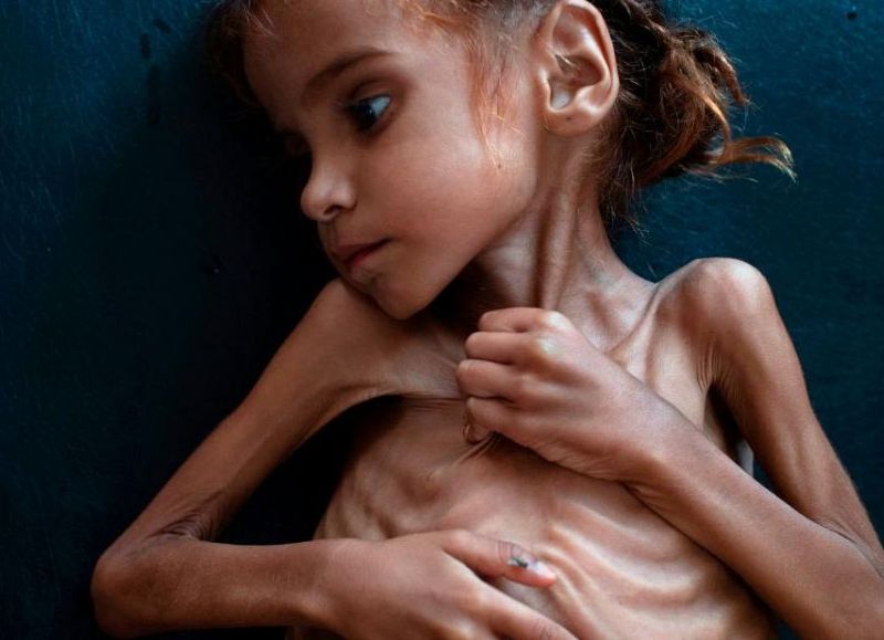 Murió una nena de 11 años por desnutrición y abandono: detuvieron a su padre en West Virginia